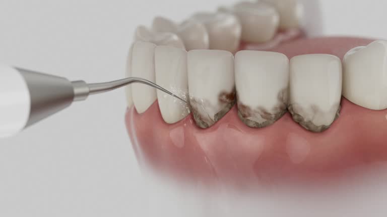 Reliable Dental Implants contractor in Palouse, WA by Smile Center Dentistry